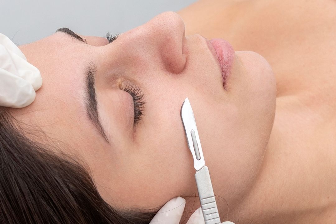 Dermaplaning